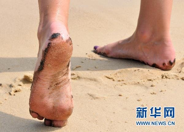 �����庣̲��������Ⱦ