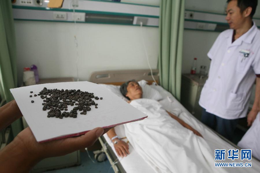 һ����ȡ��269������ʯ